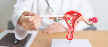 Arts legt schaalmodel van baarmoeder en eierstokken uit